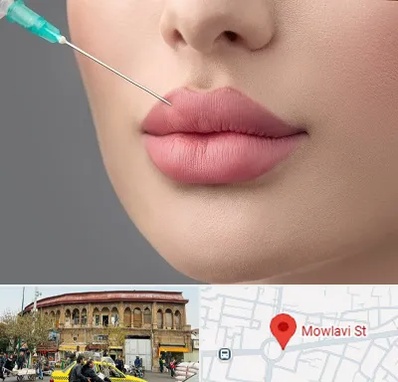 کلینیک ژل لب روسی در مولوی