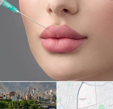 کلینیک ژل لب روسی در جمشیدیه