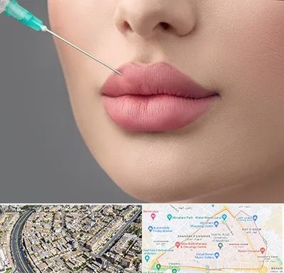 کلینیک ژل لب روسی در شهرک غرب مشهد