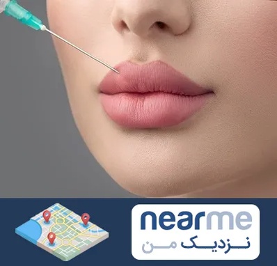 کلینیک ژل لب روسی در نزدیک من