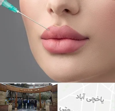 کلینیک ژل لب روسی در یاخچی آباد