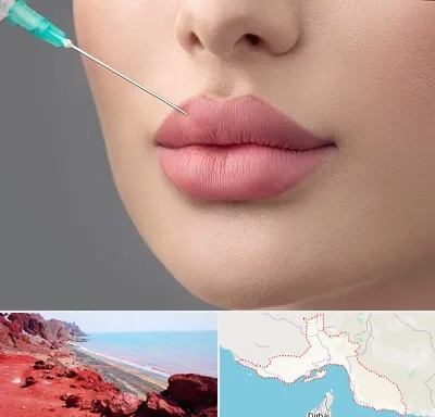 کلینیک ژل لب روسی در هرمزگان