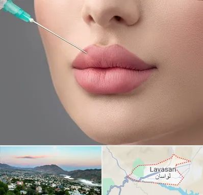 کلینیک ژل لب روسی در لواسان