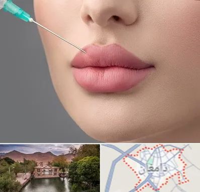 کلینیک ژل لب روسی در دامغان