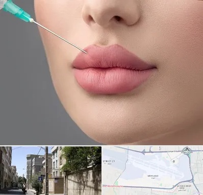 کلینیک ژل لب روسی در مهرآباد