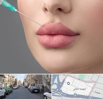 کلینیک ژل لب روسی در مجیدیه شمالی