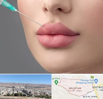 کلینیک ژل لب روسی در شهرک گلستان شیراز