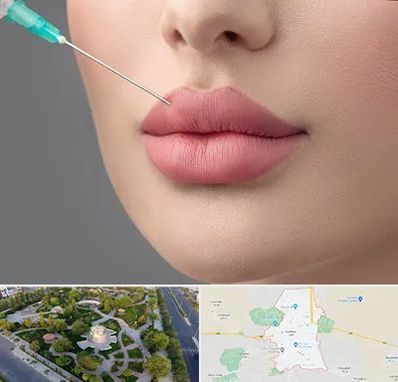 کلینیک ژل لب روسی در کاشمر