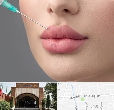 کلینیک ژل لب روسی در خواجه عبدالله