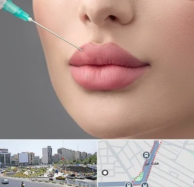 کلینیک ژل لب روسی در هفت تیر