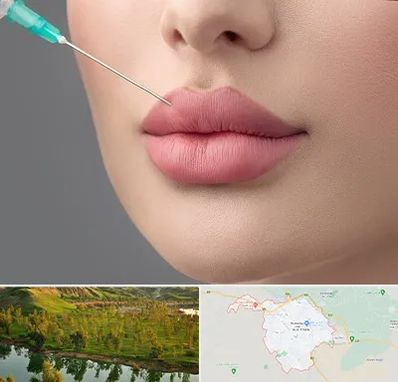 کلینیک ژل لب روسی در بهبهان