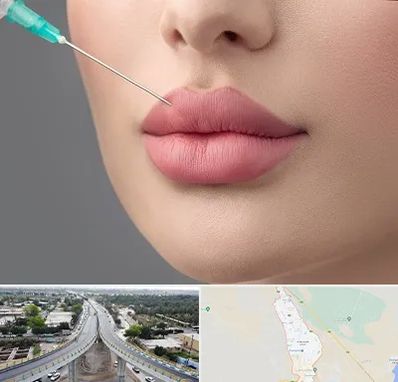 کلینیک ژل لب روسی در اندیمشک