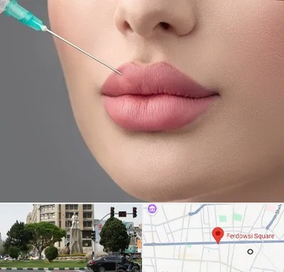 کلینیک ژل لب روسی در میدان فردوسی تهران