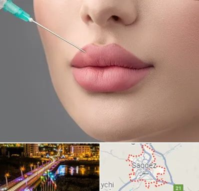 کلینیک ژل لب روسی در سقز
