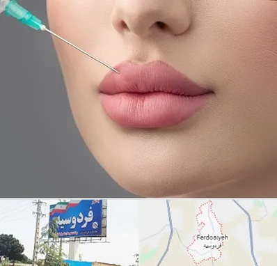 کلینیک ژل لب روسی در فردوسیه شهریار