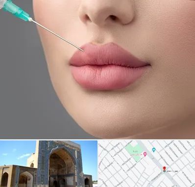 کلینیک ژل لب روسی در مصلی مشهد