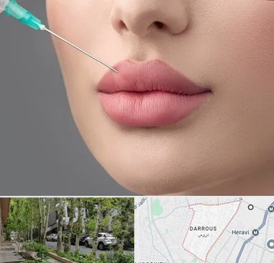 کلینیک ژل لب روسی در دروس