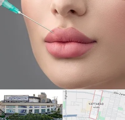 کلینیک ژل لب روسی در یافت آباد