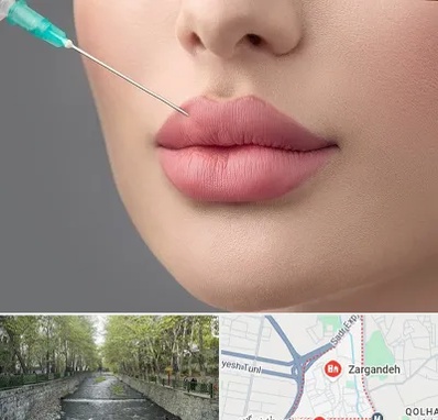 کلینیک ژل لب روسی در زرگنده