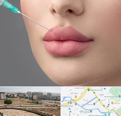 کلینیک ژل لب روسی در کوی وحدت شیراز