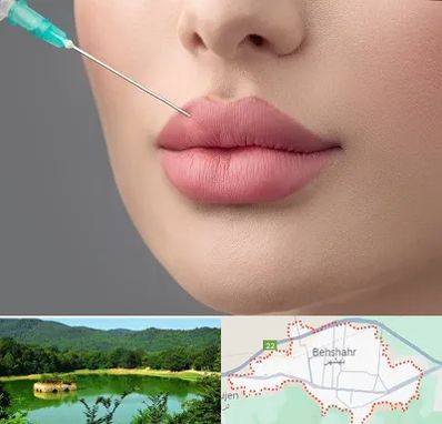 کلینیک ژل لب روسی در بهشهر
