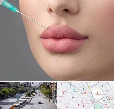 کلینیک ژل لب روسی در خیابان زند شیراز