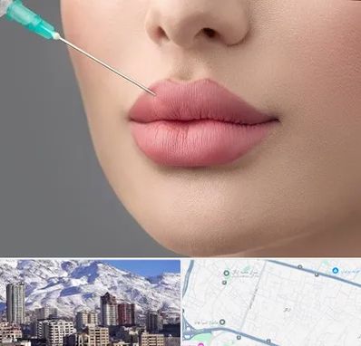 کلینیک ژل لب روسی در ازگل