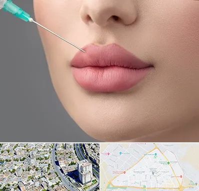 کلینیک ژل لب روسی در قاسم آباد مشهد