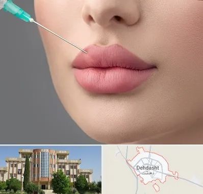 کلینیک ژل لب روسی در دهدشت