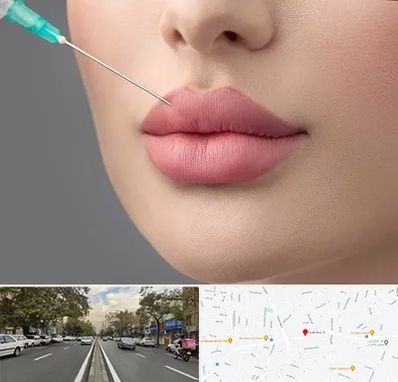 کلینیک ژل لب روسی در دولت