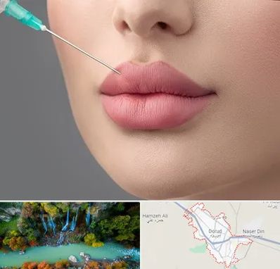 کلینیک ژل لب روسی در دورود