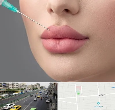 کلینیک ژل لب روسی در خیابان دامپزشکی