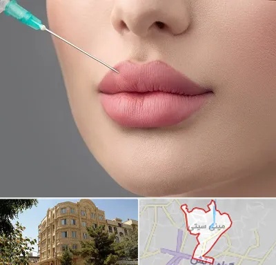 کلینیک ژل لب روسی در مینی سیتی