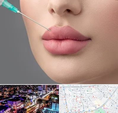 کلینیک ژل لب روسی در منظریه رشت