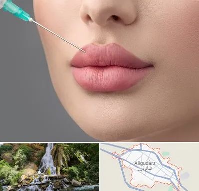 کلینیک ژل لب روسی در الیگودرز