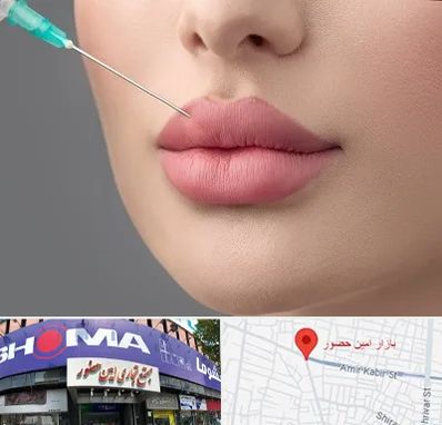 کلینیک ژل لب روسی در امین حضور