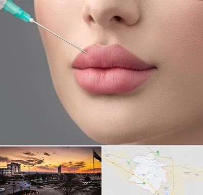 کلینیک ژل لب روسی در قوچان