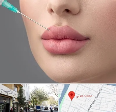کلینیک ژل لب روسی در مجیدیه جنوبی