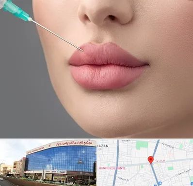 کلینیک ژل لب روسی در نصف راه تبریز