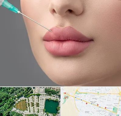 کلینیک ژل لب روسی در وکیل آباد مشهد