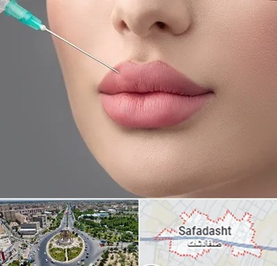 کلینیک ژل لب روسی در صفادشت