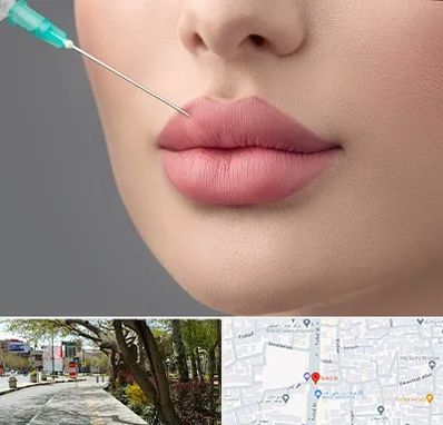 کلینیک ژل لب روسی در خیابان توحید اصفهان