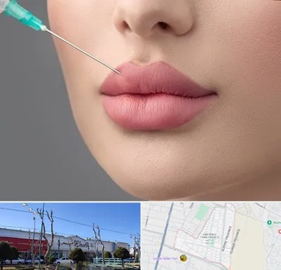 کلینیک ژل لب روسی در فاز دو اندیشه