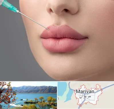 کلینیک ژل لب روسی در مریوان