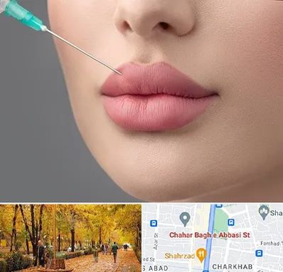 کلینیک ژل لب روسی در چهارباغ اصفهان