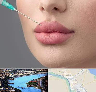 کلینیک ژل لب روسی در خرمشهر