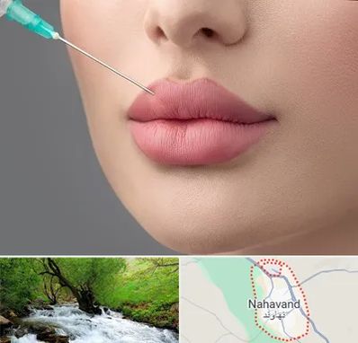 کلینیک ژل لب روسی در نهاوند