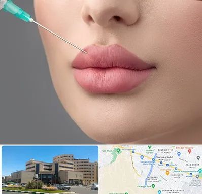 کلینیک ژل لب روسی در صیاد شیرازی مشهد