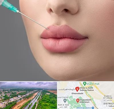 کلینیک ژل لب روسی در قصرالدشت شیراز