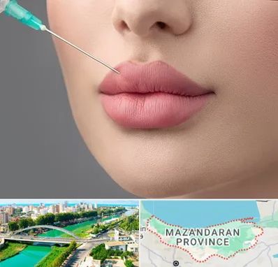 کلینیک ژل لب روسی در مازندران